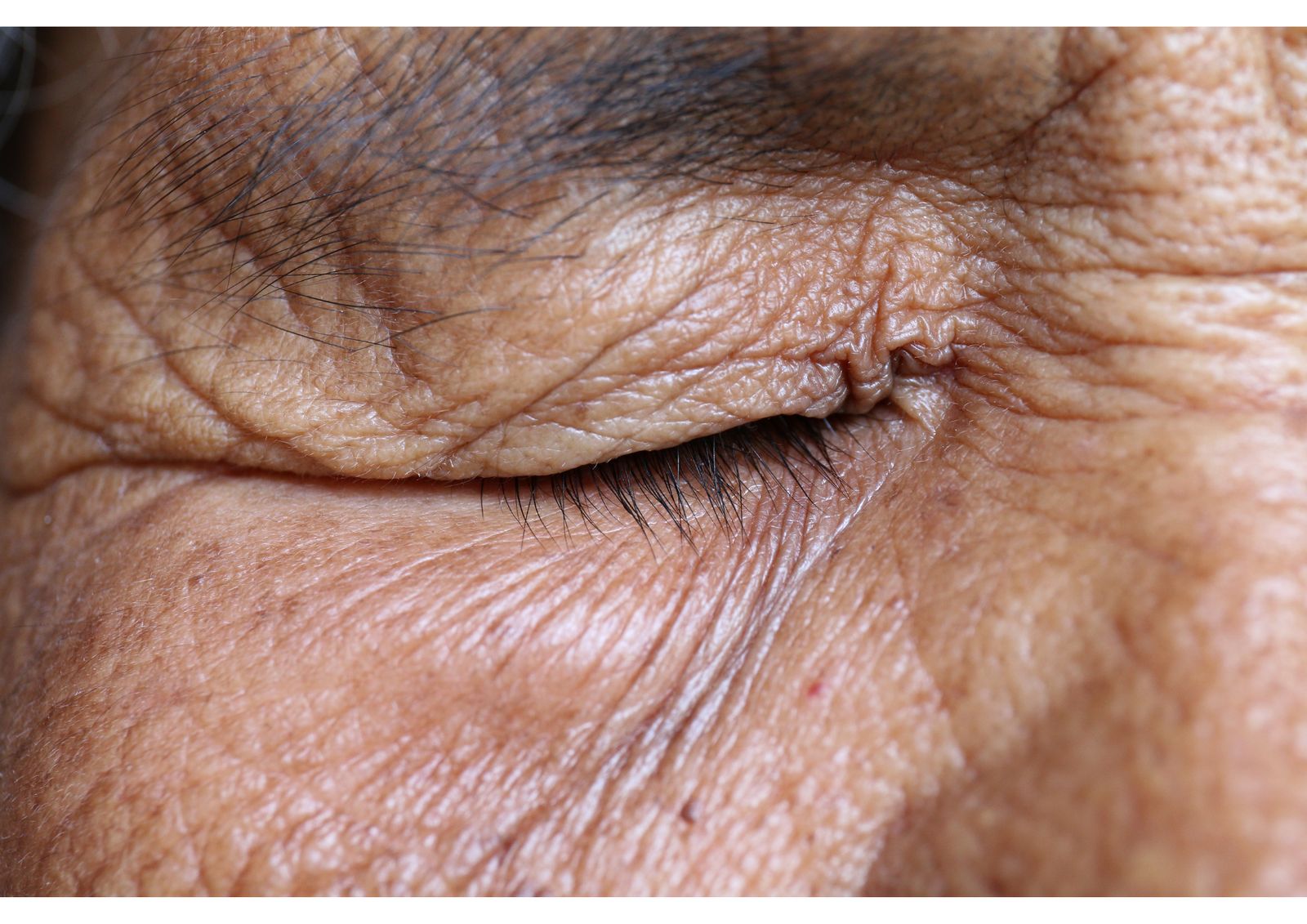 A close study of an elder's skin — every line a landscape